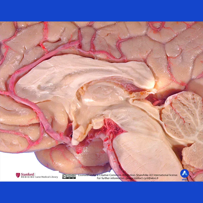 Image anatomique de l'hypothalamus