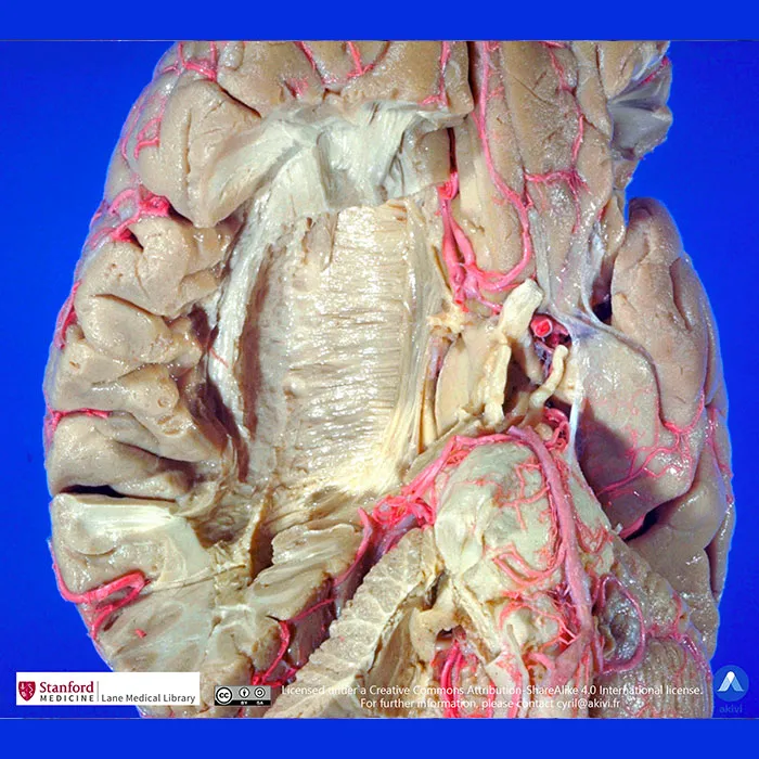 Image anatomique de l'hypothalamus
