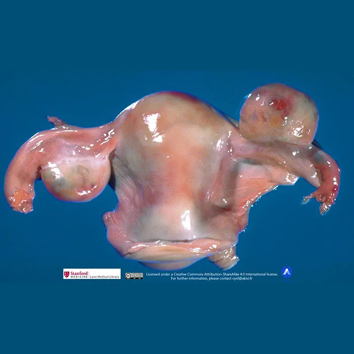 Image anatomique des ovaires